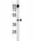 Aurora Kinase A antibody, F44002-0.4ML, NSJ Bioreagents, Western Blot image 