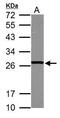 Glutathione S-Transferase Mu 5 antibody, GTX103998, GeneTex, Western Blot image 