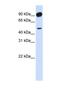 Adducin 2 antibody, NBP1-53079, Novus Biologicals, Western Blot image 