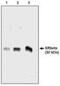 SRP Receptor Subunit Beta antibody, NBP2-66584, Novus Biologicals, Western Blot image 
