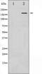 Glutamate Ionotropic Receptor NMDA Type Subunit 2B antibody, abx011228, Abbexa, Western Blot image 