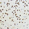 Growth Arrest And DNA Damage Inducible Alpha antibody, 16-952, ProSci, Immunohistochemistry paraffin image 