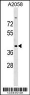 Adenosine Deaminase TRNA Specific 3 antibody, 59-152, ProSci, Western Blot image 