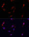 Cyclin Dependent Kinase 6 antibody, 16-567, ProSci, Immunofluorescence image 