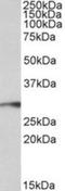 Paired Related Homeobox 1 antibody, NBP1-06067, Novus Biologicals, Western Blot image 