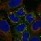 Vitronectin antibody, HPA060933, Atlas Antibodies, Immunofluorescence image 