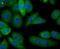 Alcohol Dehydrogenase 1A (Class I), Alpha Polypeptide antibody, NBP2-75398, Novus Biologicals, Immunofluorescence image 