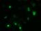 Zinc Finger Imprinted 2 antibody, MA5-25331, Invitrogen Antibodies, Immunocytochemistry image 