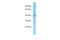 Olfactory Receptor Family 1 Subfamily I Member 1 antibody, A17537, Boster Biological Technology, Western Blot image 