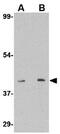 Sphingosine-1-Phosphate Receptor 1 antibody, GTX31360, GeneTex, Western Blot image 