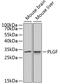 Placental Growth Factor antibody, 16-900, ProSci, Western Blot image 