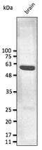 GFAP antibody, AB0165-100, Origene, Western Blot image 