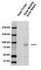 ENaCB antibody, TA309327, Origene, Western Blot image 