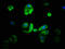 Cytochrome P450 Family 21 Subfamily A Member 2 antibody, CSB-PA006400LA01HU, Cusabio, Immunofluorescence image 