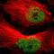 Mediator Complex Subunit 15 antibody, NBP1-89018, Novus Biologicals, Immunofluorescence image 