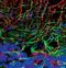 Neurofilament Light antibody, MA5-14981, Invitrogen Antibodies, Immunofluorescence image 