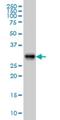 ADP Ribosylation Factor Like GTPase 6 Interacting Protein 4 antibody, H00051329-M09, Novus Biologicals, Western Blot image 