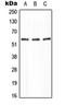 Protein Phosphatase 2 Regulatory Subunit B'Alpha antibody, orb214430, Biorbyt, Western Blot image 