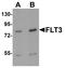 Fms Related Tyrosine Kinase 3 antibody, LS-B8864, Lifespan Biosciences, Western Blot image 