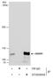 Adenosine Deaminase RNA Specific antibody, GTX629000, GeneTex, Immunoprecipitation image 