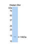 Slit Guidance Ligand 1 antibody, LS-C299611, Lifespan Biosciences, Western Blot image 