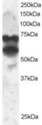 Protein Phosphatase 2 Regulatory Subunit B'Delta antibody, 46-211, ProSci, Western Blot image 