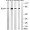 Ezrin antibody, A01750, Boster Biological Technology, Western Blot image 