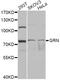 Granulin Precursor antibody, A12440, ABclonal Technology, Western Blot image 