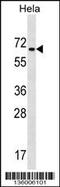 Zinc Finger Protein 35 antibody, 58-494, ProSci, Western Blot image 