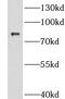 CCR4-NOT Transcription Complex Subunit 10 antibody, FNab01806, FineTest, Western Blot image 