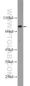 Cytoplasmic Polyadenylation Element Binding Protein 4 antibody, 25342-1-AP, Proteintech Group, Western Blot image 