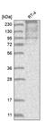 Transforming Acidic Coiled-Coil Containing Protein 2 antibody, PA5-56618, Invitrogen Antibodies, Western Blot image 