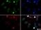 RAD51 Paralog D antibody, NB100-178, Novus Biologicals, Immunocytochemistry image 
