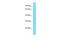 Centromere Protein L antibody, A12321, Boster Biological Technology, Western Blot image 