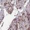 Adenosine Monophosphate Deaminase 3 antibody, PA5-61505, Invitrogen Antibodies, Immunohistochemistry paraffin image 