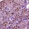 Platelet Derived Growth Factor Receptor Beta antibody, A00096-1, Boster Biological Technology, Immunohistochemistry paraffin image 