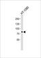 Arf-GAP with GTPase, ANK repeat and PH domain-containing protein 8 antibody, PA5-49343, Invitrogen Antibodies, Western Blot image 