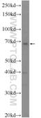 Deltex E3 Ubiquitin Ligase 4 antibody, 25222-1-AP, Proteintech Group, Western Blot image 