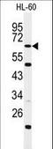 WD And Tetratricopeptide Repeats 1 antibody, LS-C160614, Lifespan Biosciences, Western Blot image 