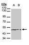 Keratin 18 antibody, GTX105624, GeneTex, Western Blot image 