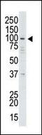 Ubiquitin Specific Peptidase 13 antibody, 61-107, ProSci, Western Blot image 