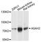 N-Acylsphingosine Amidohydrolase 2 antibody, LS-C747690, Lifespan Biosciences, Western Blot image 