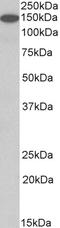 TBC1 Domain Family Member 9 antibody, 43-443, ProSci, Western Blot image 