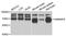 Heterogeneous Nuclear Ribonucleoprotein R antibody, A5883, ABclonal Technology, Western Blot image 