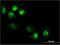 Pleckstrin Homology Like Domain Family A Member 1 antibody, H00022822-M08, Novus Biologicals, Immunofluorescence image 