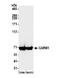 Coactivator Associated Arginine Methyltransferase 1 antibody, NB200-342, Novus Biologicals, Western Blot image 