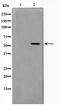 Transcription Factor Dp-1 antibody, TA347371, Origene, Western Blot image 