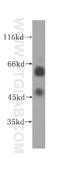 Uridine-Cytidine Kinase 1 Like 1 antibody, 17005-1-AP, Proteintech Group, Western Blot image 