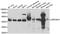 ADP Ribosylation Factor GTPase Activating Protein 1 antibody, A7118, ABclonal Technology, Western Blot image 