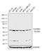 Transforming Growth Factor Beta Receptor 1 antibody, PA1-38737, Invitrogen Antibodies, Western Blot image 